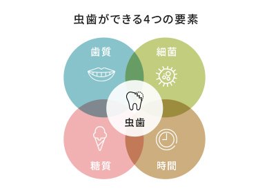 虫歯が発生する仕組み イメージ