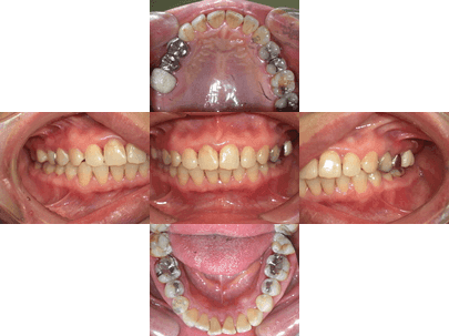 カラム_02 イメージ
