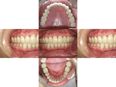 カラム_02 イメージ