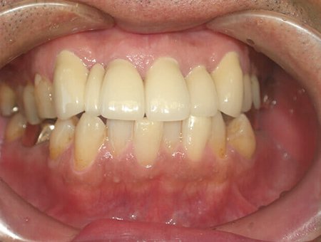 歯並びと噛み合わせ 症例写真