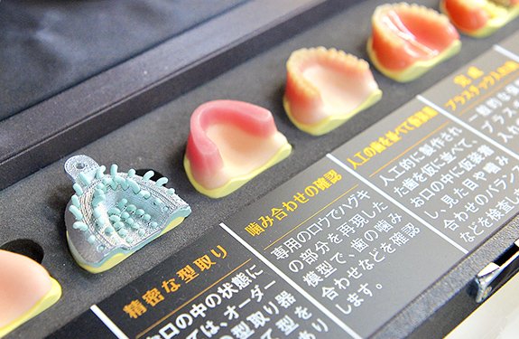 噛む力と生活の質を支える選択肢 イメージ