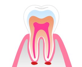 治療が必要となる主なケースと症状 イメージ2