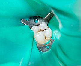 精密な治療を支える3つの重要な取り組み イメージ1