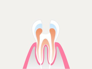 治療の流れ イメージ8