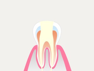 治療の流れ イメージ10