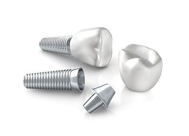 インプラント保証期間 イメージ