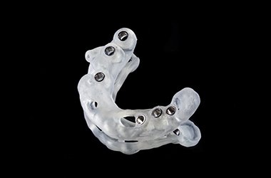 サージカルガイド