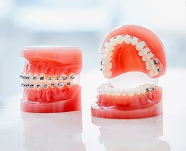 透明感のあるワイヤー