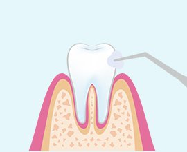 予防メニュー イメージ1