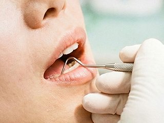 歯周病治療の流れ イメージ1