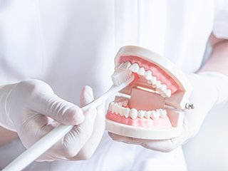 歯周病治療の流れ イメージ2