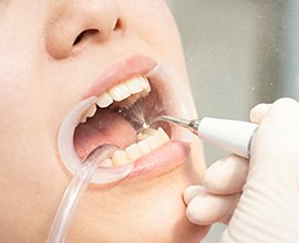 カラム_04 イメージ1