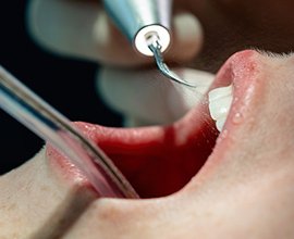 カラム_04 イメージ1