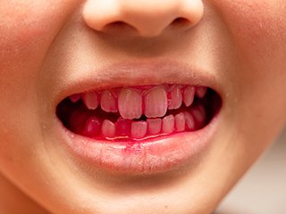 フロー_A_06 イメージ3