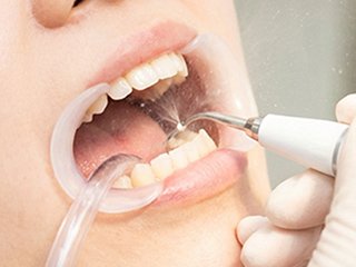 フロー_A_06 イメージ3