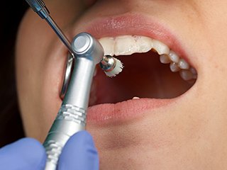 フロー_A_06 イメージ3