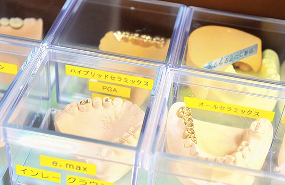 歯を失ったら イメージ