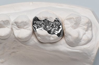 金銀パラジウム合金