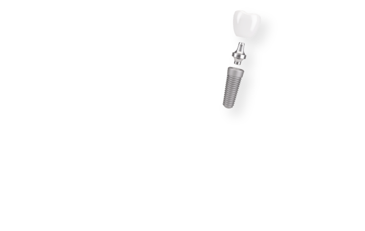 人生100年時代のインプラントを。-末永く続く安心と満足を実現します。-